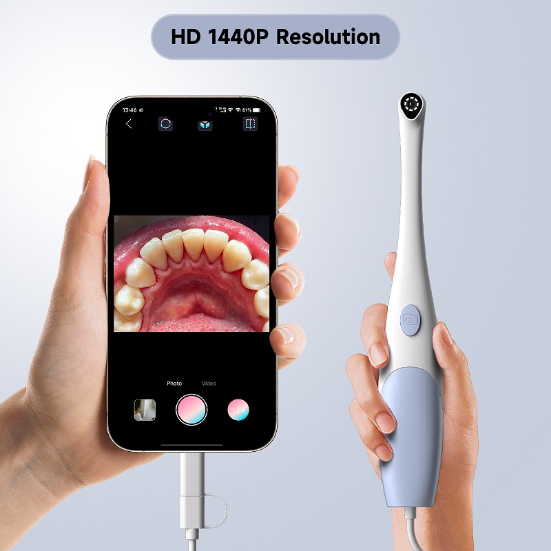 Oral Endoscope Camera 1440P Ph - огляд і ціна Macro Photography Led Lighting