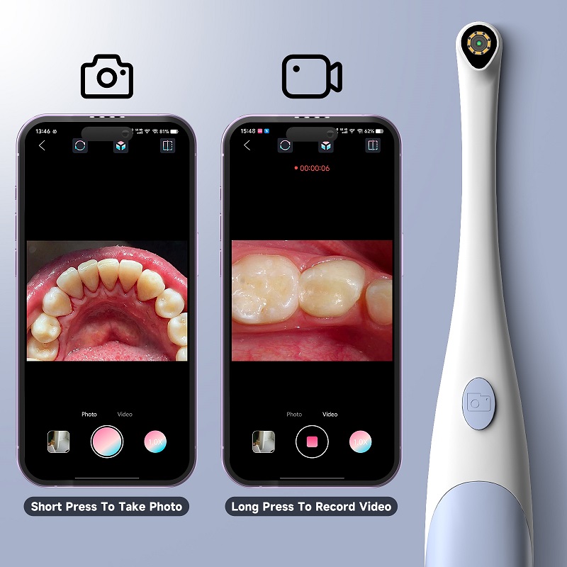 Oral Endoscope Camera 1440P Ph - огляд і ціна Macro Photography Led Lighting